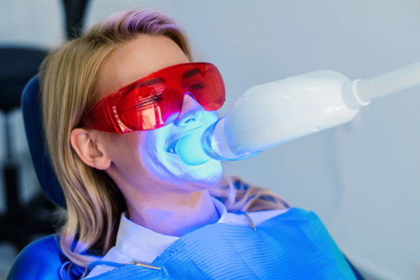 Teeth Whitening in Riyadh